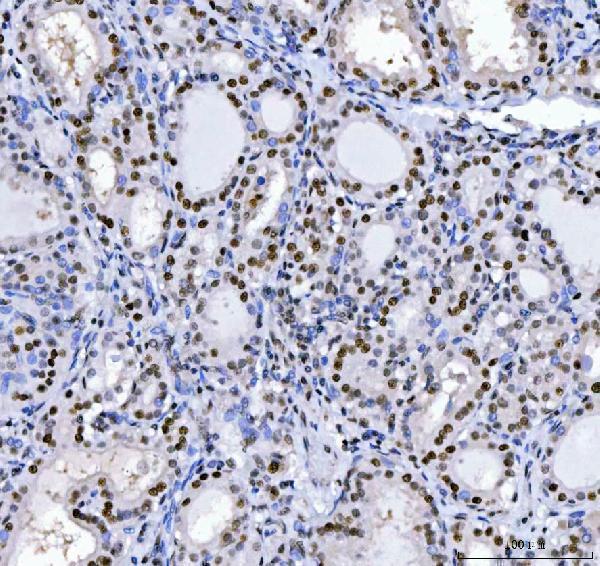 a02309 1 mbnl1 primary antibodies ihc testing 2_1