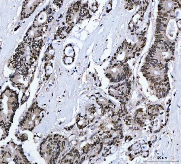 a02309 1 mbnl1 primary antibodies ihc testing 3_1