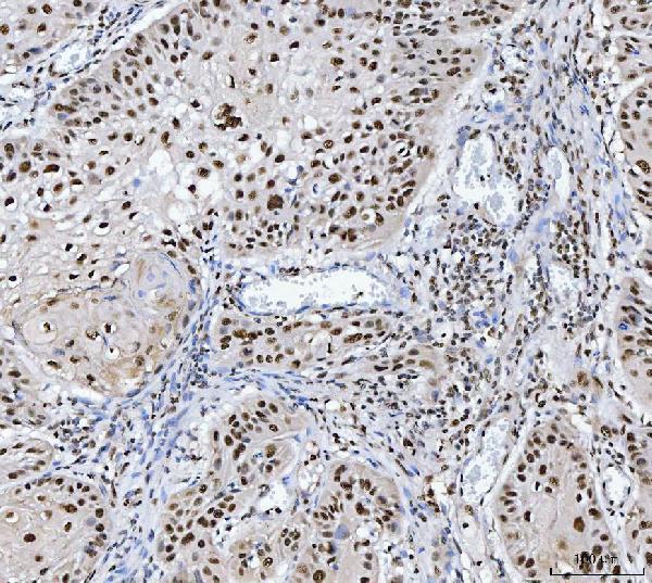 a02309 1 mbnl1 primary antibodies ihc testing 4_1