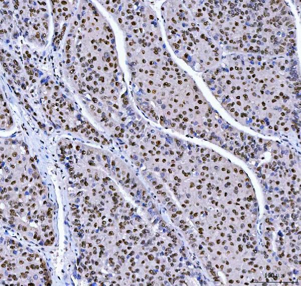a02309 1 mbnl1 primary antibodies ihc testing 5