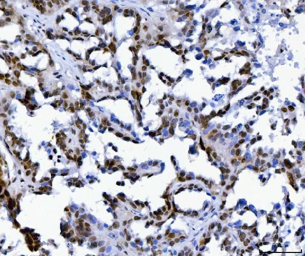 a02309 1 mbnl1 primary antibodies ihc testing 6