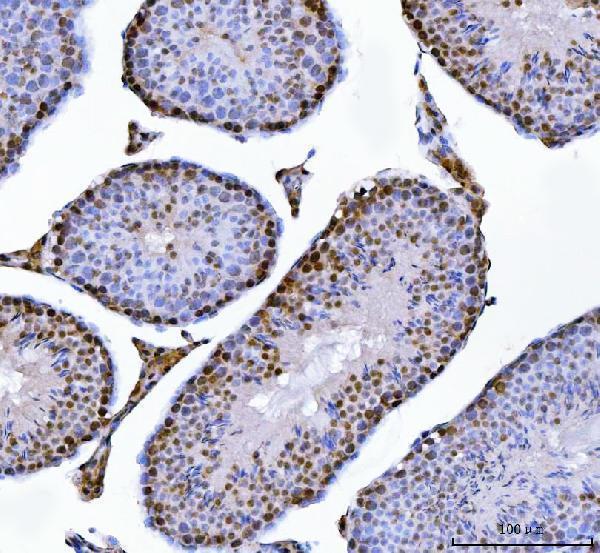 a02309 1 mbnl1 primary antibodies ihc testing 7