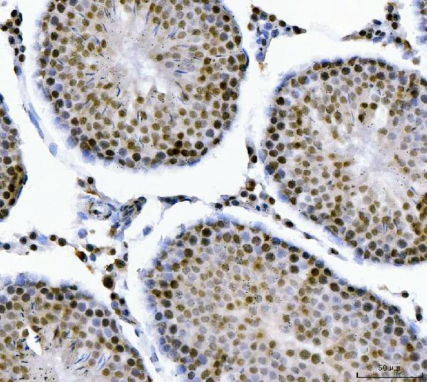 a02309 1 mbnl1 primary antibodies ihc testing 8