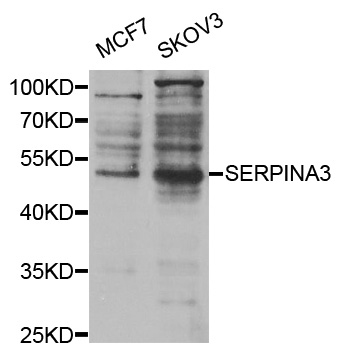 a02312 1 serpina3 primary antiboties wb testing 1