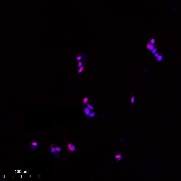 Immunofluorescence analysis of MCF7 cell