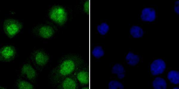 a02313 2 ilf3 primary antiboties icc testing 2