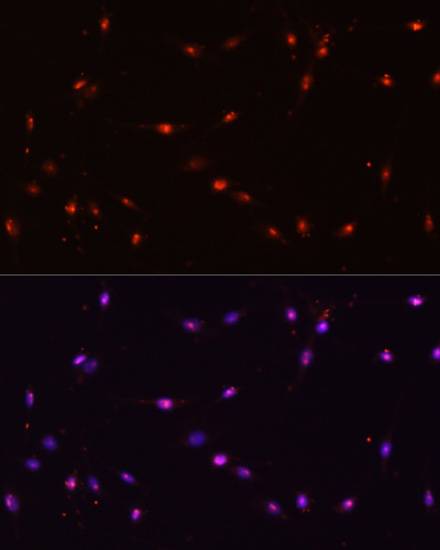 Immunofluorescence analysis of C6 cells using ILF3 antibody  at dilution of 1:100