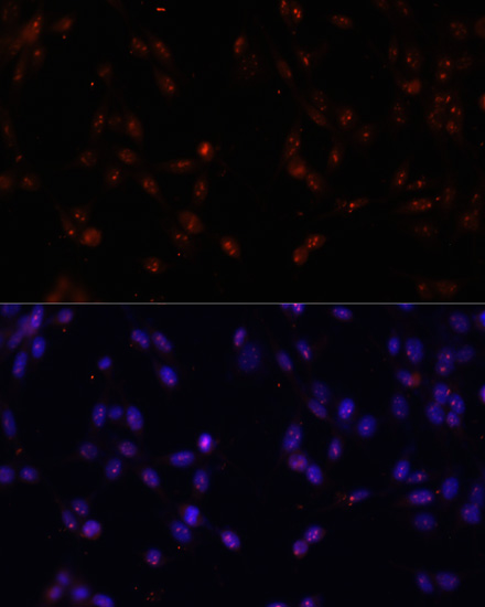Immunofluorescence analysis of NIH-3T3 cells using ILF3 antibody  at dilution of 1:100