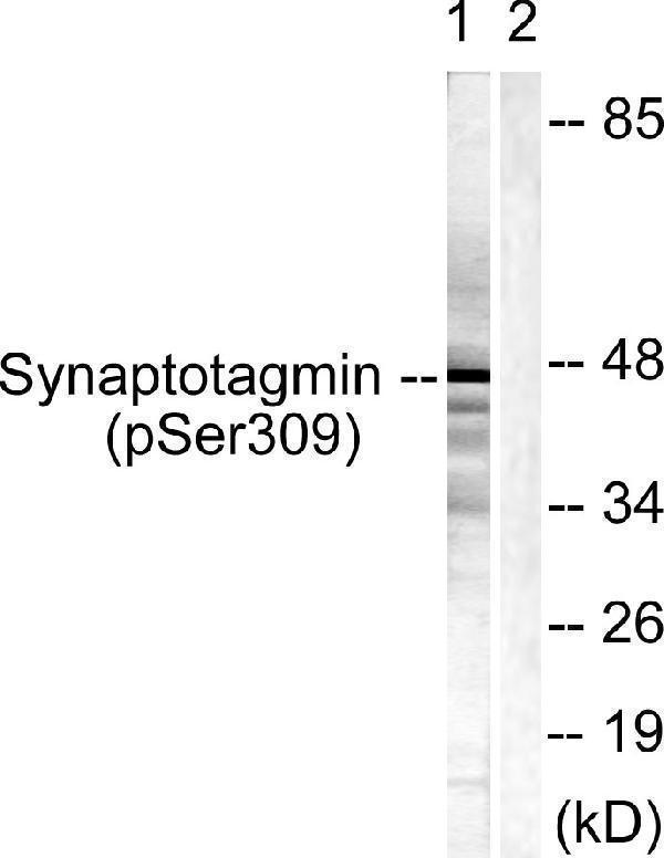 Western blot analysis of lysates from 293 cells treated with Sobital 0