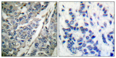 Immunohistochemistry validation of SYT1 using Anti-Phospho-Synaptotagmin 1/2 (T202/199) SYT1 Antibody (A02314T202)