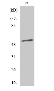 Western blotting validation for Anti-Phospho-Synaptotagmin 1/2 (T202/199) SYT1 Antibody A02314T202
Western Blot (WB) analysis of specific cells using Phospho-Synaptotagmin 1/2 (T202/199) polyclonal antibody