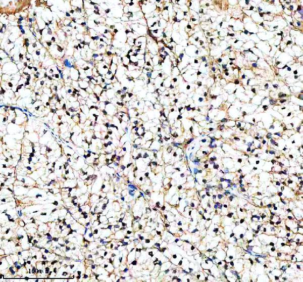 IHC analysis of PIF1 using anti-PIF1 antibody (A02315-1)