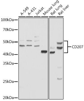 a02316 1 cd207 primary antiboties wb testing 1