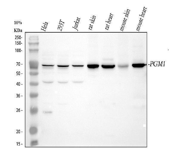  Western blot analysis of PGM1 using anti-PGM1 antibody (A02318-2)
