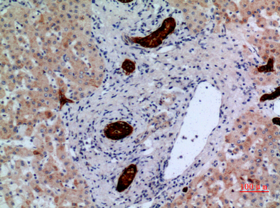 a02319 1 ptprj primary antibodies ihc testing 1