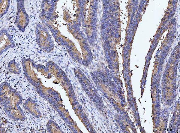  IHC analysis of DEP1/PTPRJ using anti-DEP1/PTPRJ antibody (A02319-2)