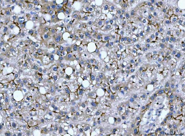  IHC analysis of DEP1/PTPRJ using anti-DEP1/PTPRJ antibody (A02319-2)