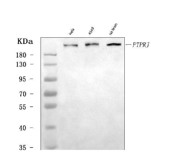  Western blot analysis of DEP1/PTPRJ using anti-DEP1/PTPRJ antibody (A02319-2)