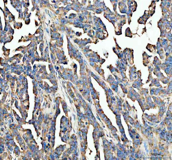 a02320 1 cd151 primary antibodies ihc testing 1