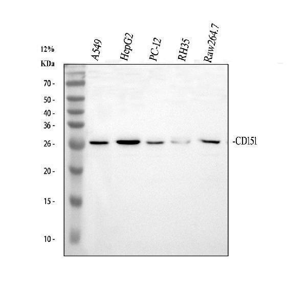 a02320 1 cd151 primary antibodies wb testing 1