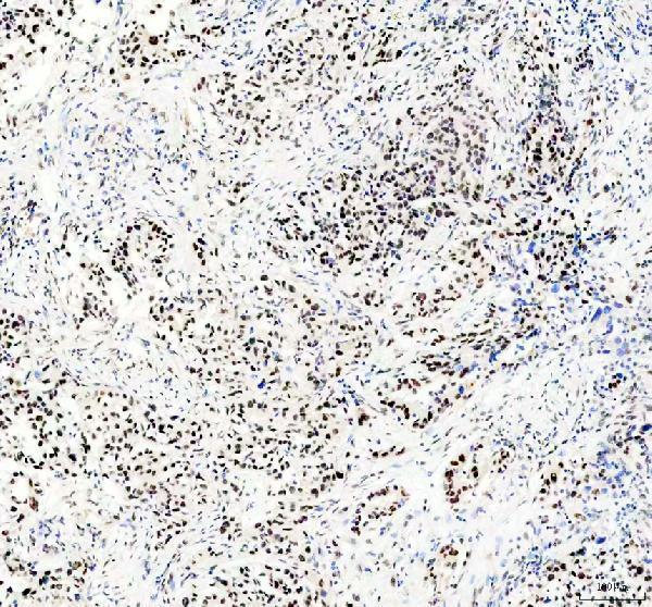 IHC analysis of HEXIM1 using anti-HEXIM1 antibody (A02321-2)