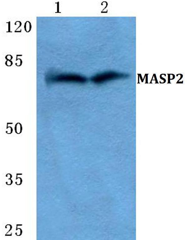 a02323 masp2 primary antiboties wb testing 1