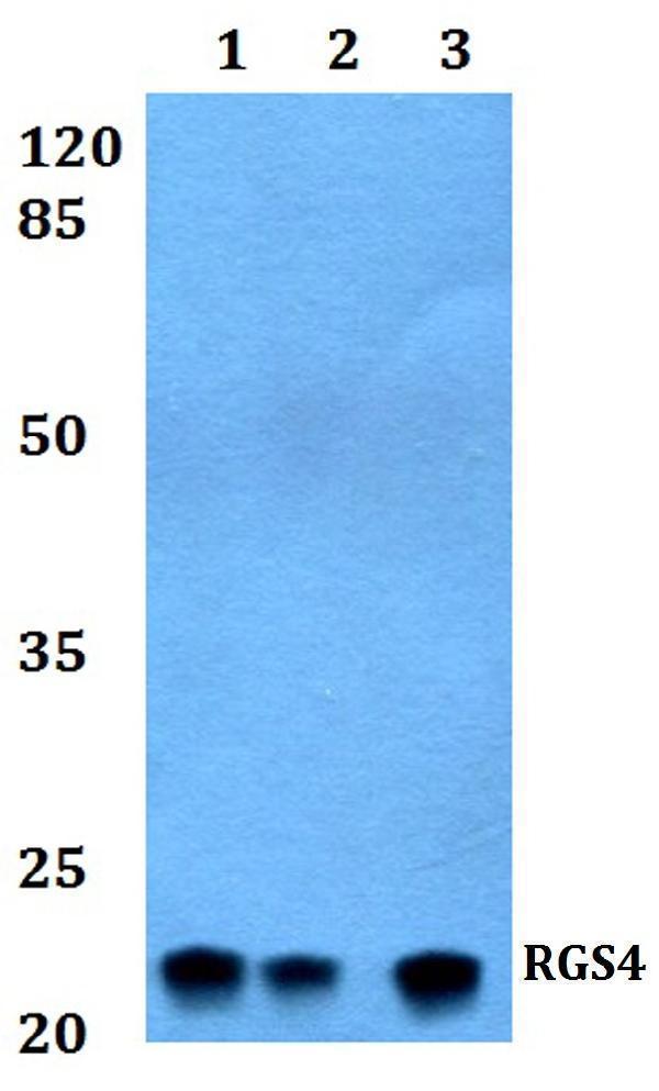 Western blot (WB) analysis of RGS4 polyclonal antibody at 1:500 dilution
Lane1:HepG2 whole cell lysate
Lane2:sp2/0 whole cell lysate
Lane3:PC12 whole cell lysate