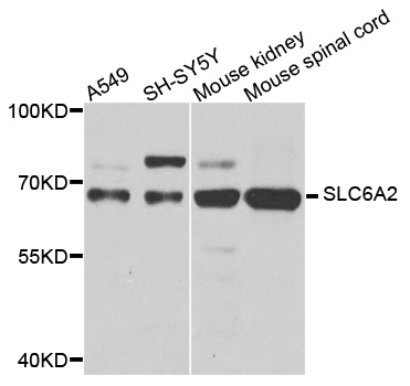 a02326 slc6a2 primary antiboties wb testing 1
