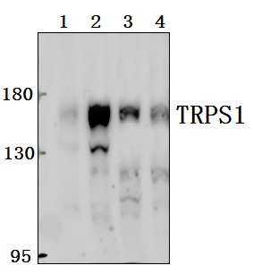 Western blot (WB) analysis of TRPS1 polyclonal antibody at 1:500 dilution
Lane1:Hela whole cell lysate(40ug)
Lane2:PC3 whole cell lysate(40ug)
Lane3:The fetal Brain tissue lysate of Mouse(40ug)
Lane4:The fetal Brain tissue lysate of Rat(40ug)