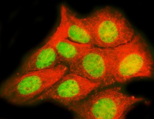  IF analysis of TRPS1 using anti-TRPS1 antibody (A02328-2) and anti-Tubulin Alpha antibody (M03989-3)