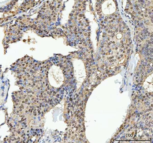  IHC analysis of TRPS1 using anti-TRPS1 antibody (A02328-2)