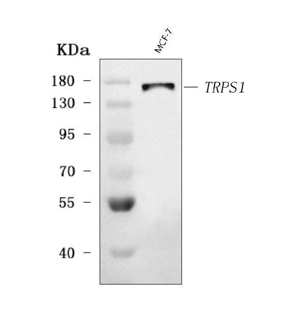  Western blot analysis of TRPS1 using anti-TRPS1 antibody (A02328-2)