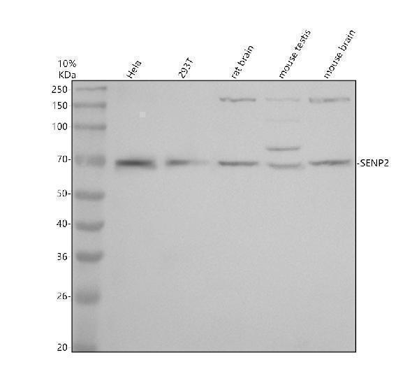 Western blot analysis of SENP2 using anti-SENP2 antibody (A02329-3)