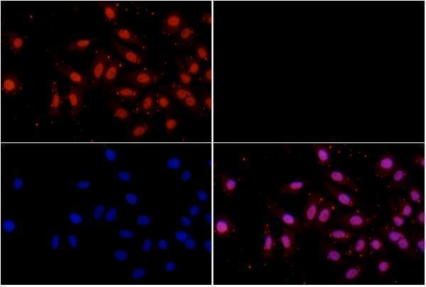 a02330 1 mx2 primary antiboties if testing 3