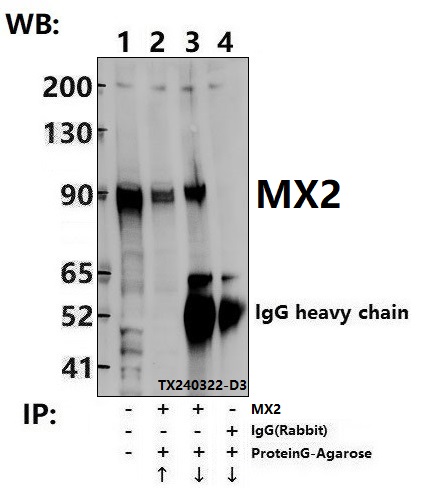 a02330 1 mx2 primary antiboties ip testing 4