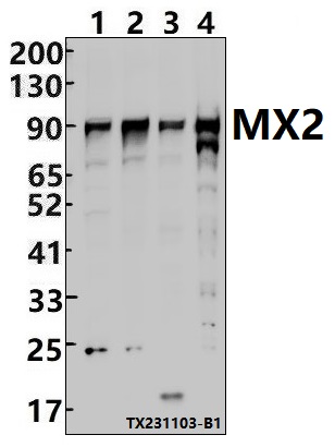 a02330 1 mx2 primary antiboties wb testing 1