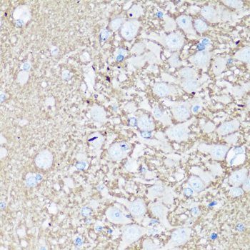 Immunohistochemistry of paraffin-embedded rat brain using VAMP2 antibody  at dilution of 1:100 