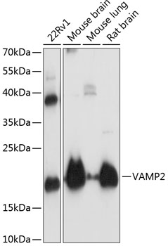 Western blot analysis of extracts of various cell lines, using VAMP2 antibody  at 1:3000 dilution