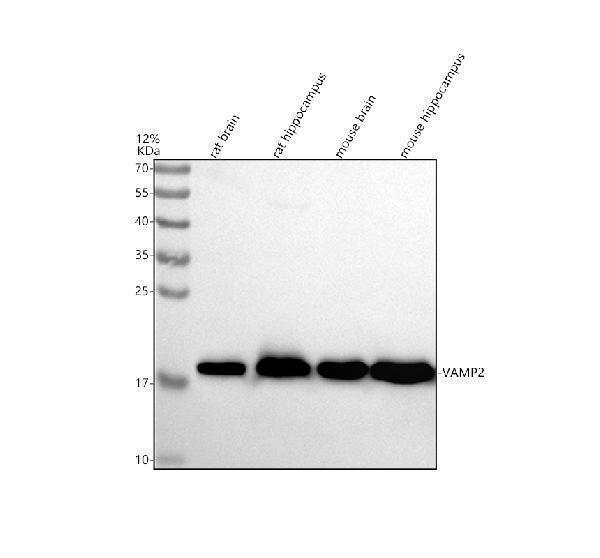 Western blot analysis of VAMP2 using anti-VAMP2 antibody (A02331-3)