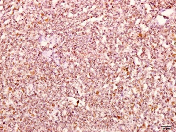 a02333 2 ctnnd1 primary antiboties ihc testing 2