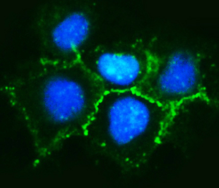 a02333 3 ctnnd1 primary antibodies if testing 6