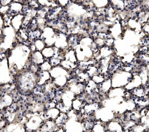  IHC analysis of delta 1 Catenin/CAS/CTNND1 using anti-delta 1 Catenin/CAS/CTNND1 antibody (A02333-3)