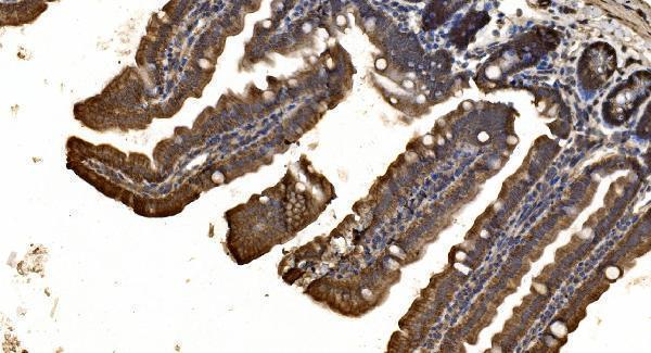 a02333 3 ctnnd1 primary antibodies ihc testing 4