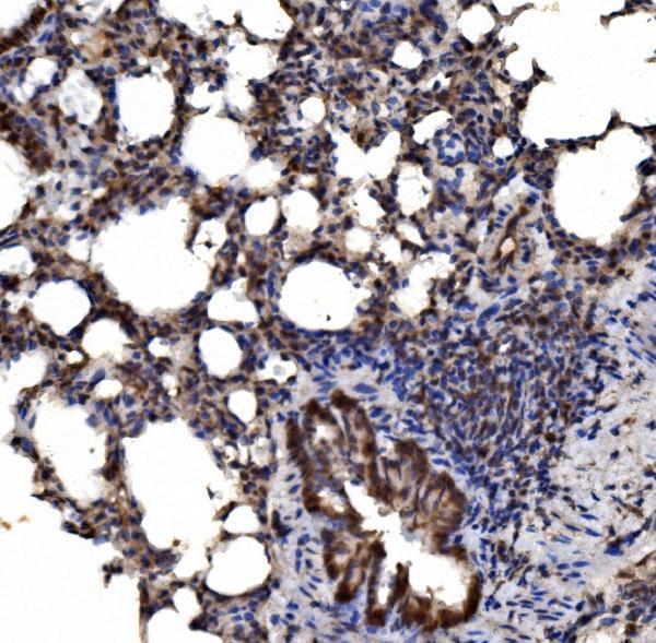 a02333 3 ctnnd1 primary antibodies ihc testing 5