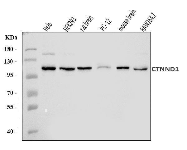  Western blot analysis of delta 1 Catenin/CAS/CTNND1 using anti-delta 1 Catenin/CAS/CTNND1 antibody (A02333-3)
