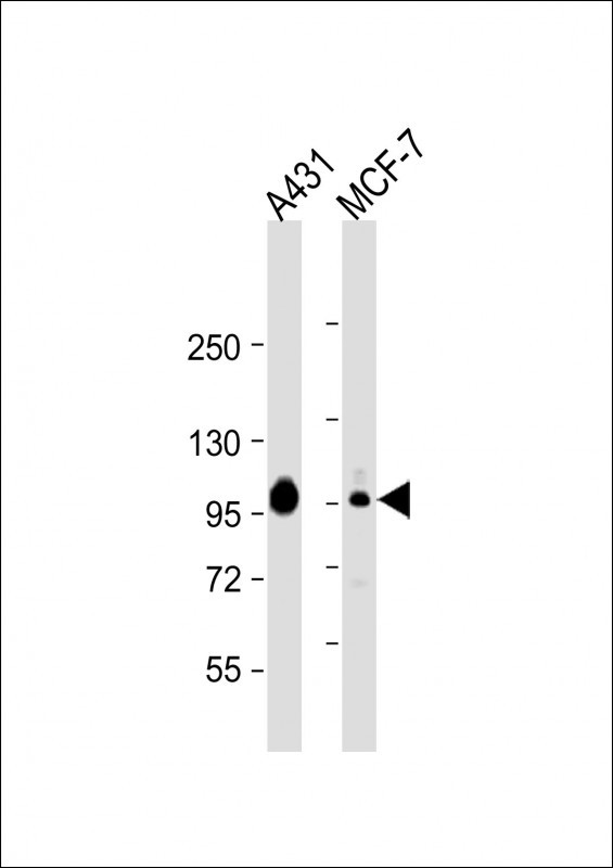 All lanes : Anti-HUMAN-CTNND1_isform 2ABC (Y174) Antibody at 1:2000 dilutionLane 1: A431 whole cell lysateLane 2: MCF-7 whole cell lysateLysates/proteins at 20 µg per lane