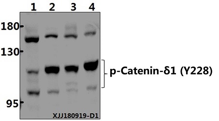 a02333y228 ctnnd1 primary antiboties wb testing 1