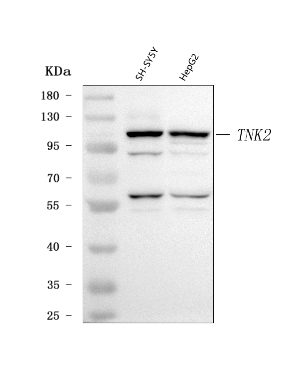  Western blot analysis of ACK1/TNK2 using anti-ACK1/TNK2 antibody (A02334-1)