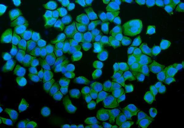 a02335 1 p4hb primary antibodies if testing 9