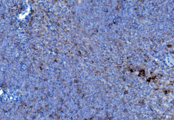 a02335 1 p4hb primary antibodies ihc testing 2